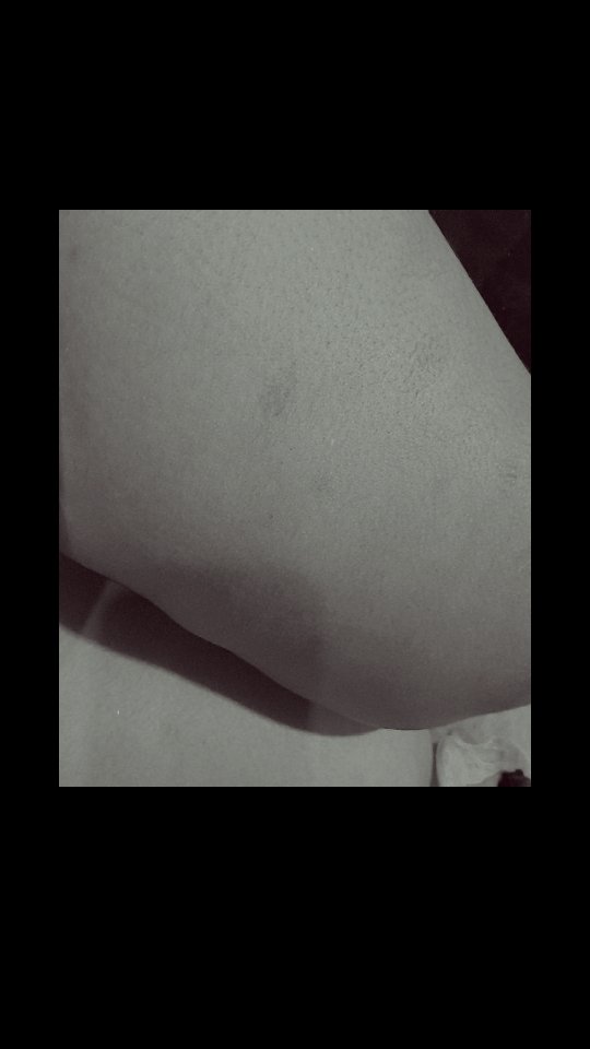 Status photo